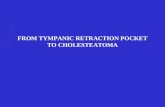 FROM TYMPANIC RETRACTION POCKET TO CHOLESTEATOMA