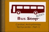 Bus Bites- Cardiac Arrhythmias