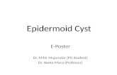 Epidermoid Cyst