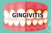 Presentacion gingivitis